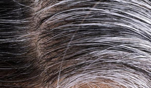 Tips για να καλύψετε τα λευκά μαλλιά